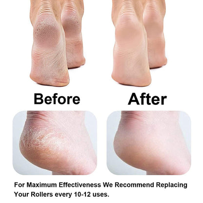 Rechargeable Electric Foot Pedicure Device – Callus Remover & Electronic Foot File (For Dry, Hard & Dead Skin)